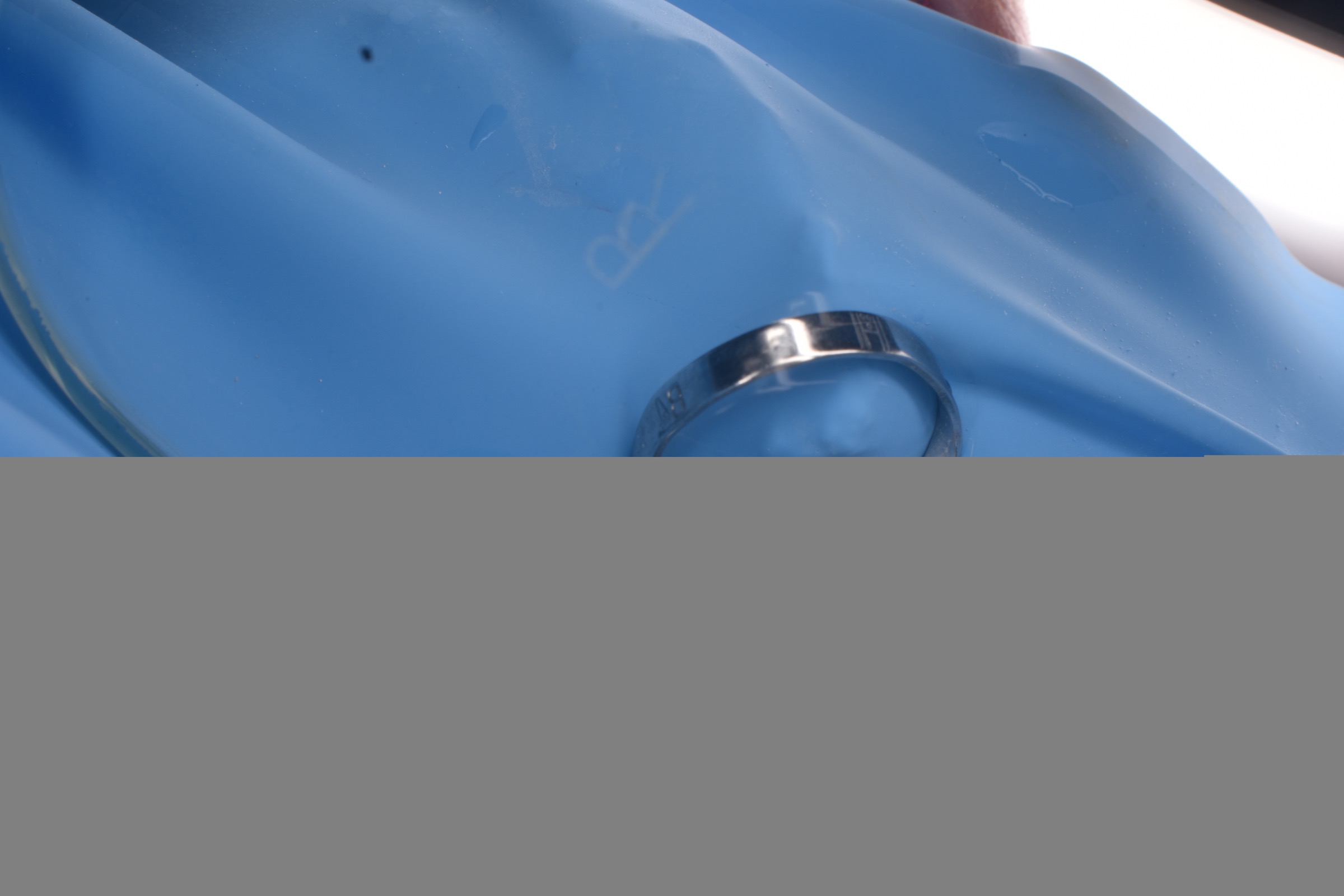 Class I restoration with Fibrafill, cavity preparation.