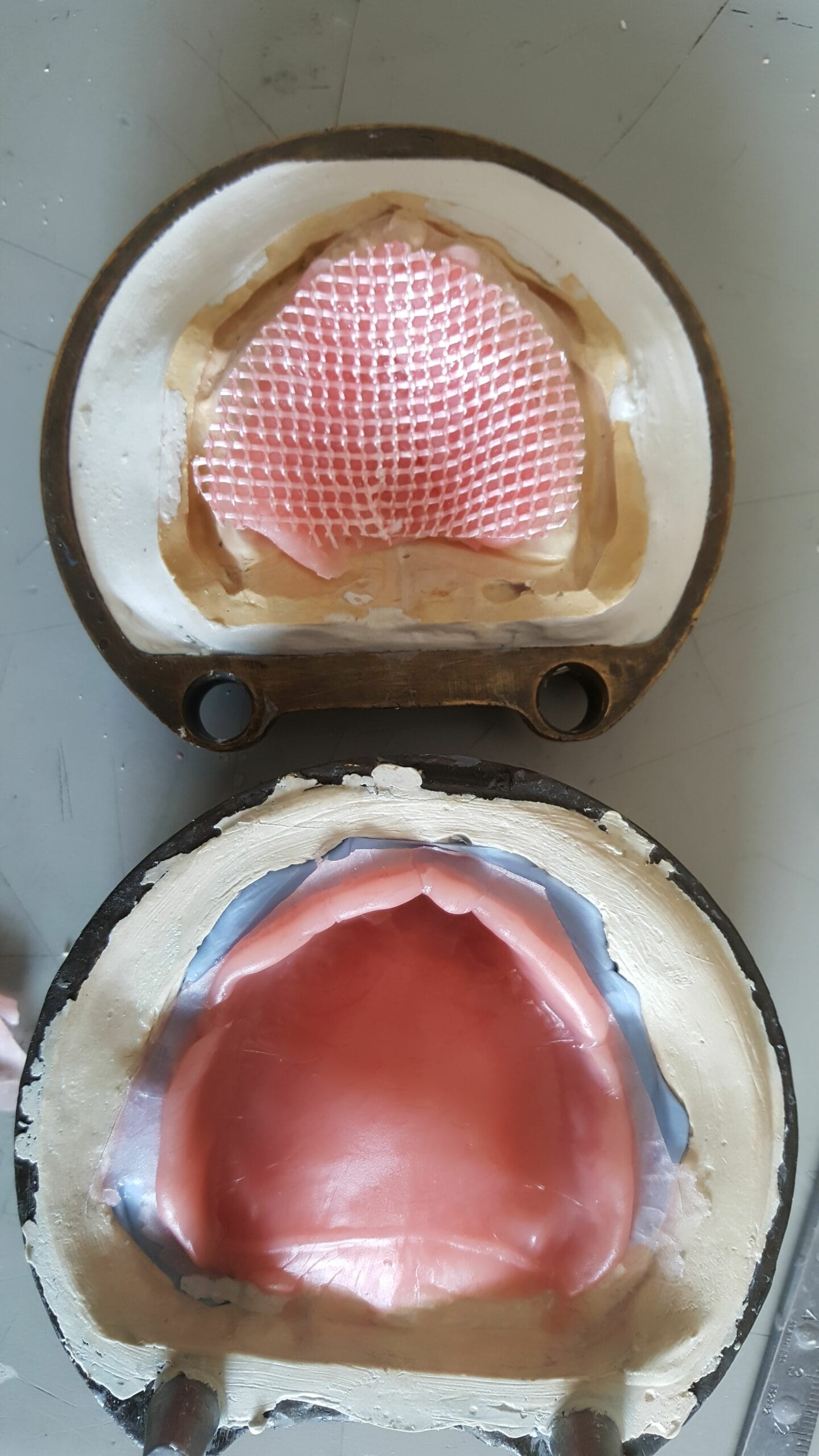 Denture reinforcement with Dentapreg MESH, second clinical step.