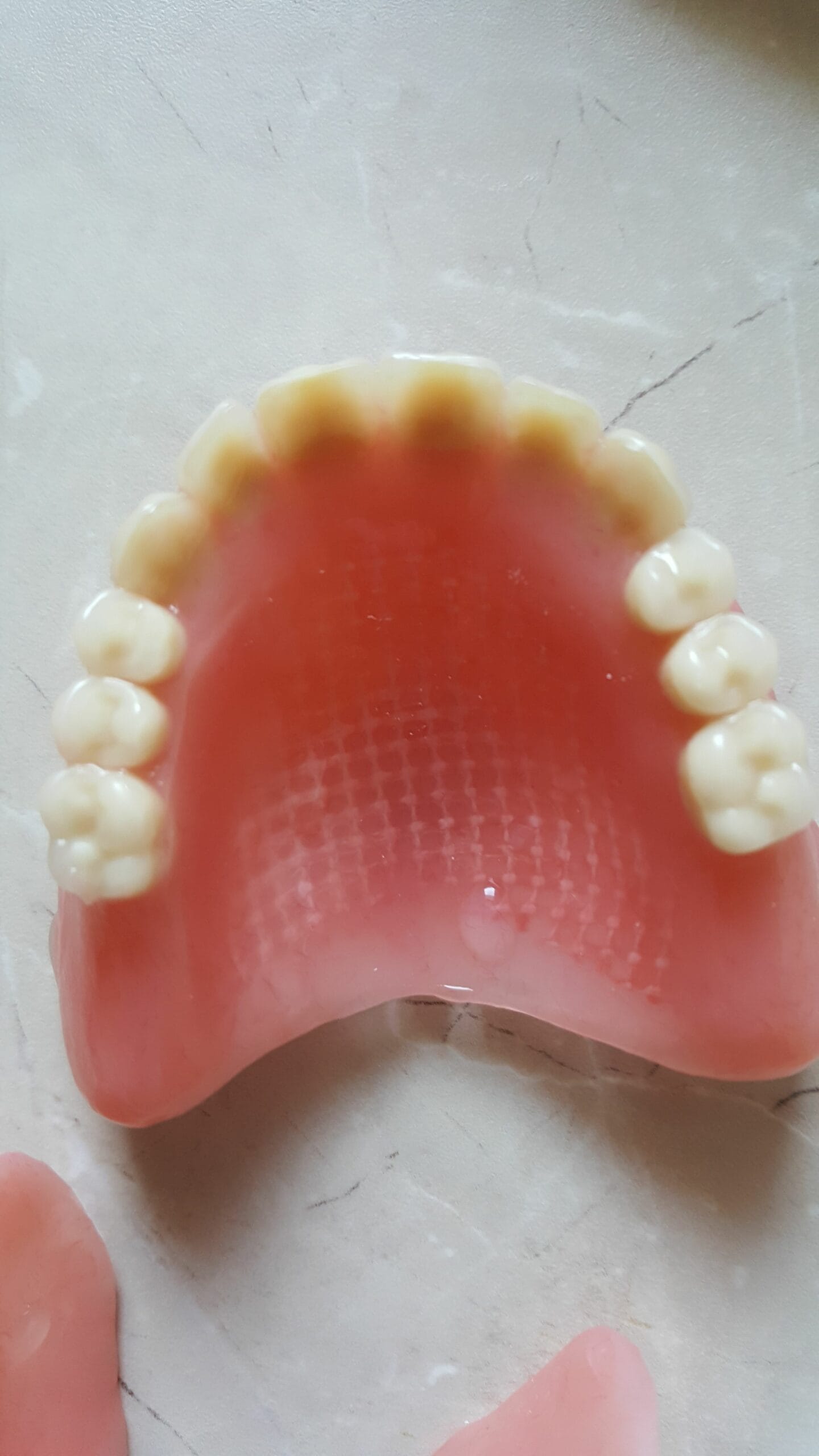 Completed denture reinforced with Dentapreg MESH.
