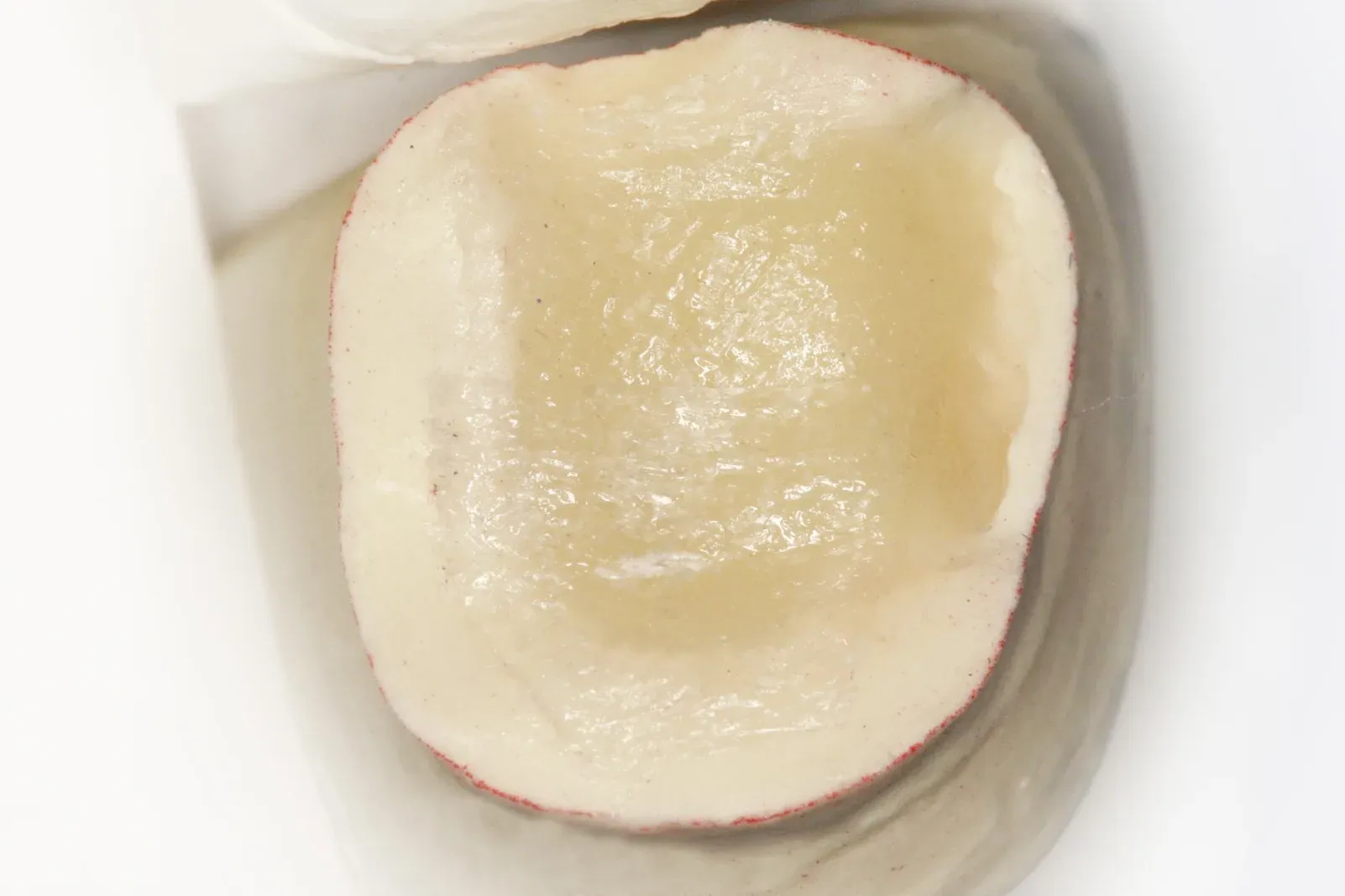 Placement of Dentapreg VEIL into the uncured composite layer.