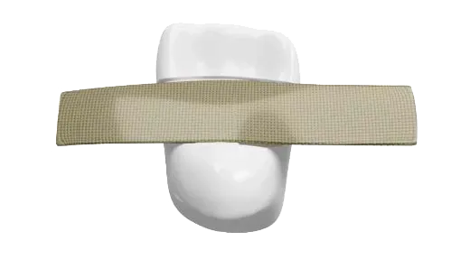 Dentapreg® BRAID on tooth model demonstrating stabilization use.