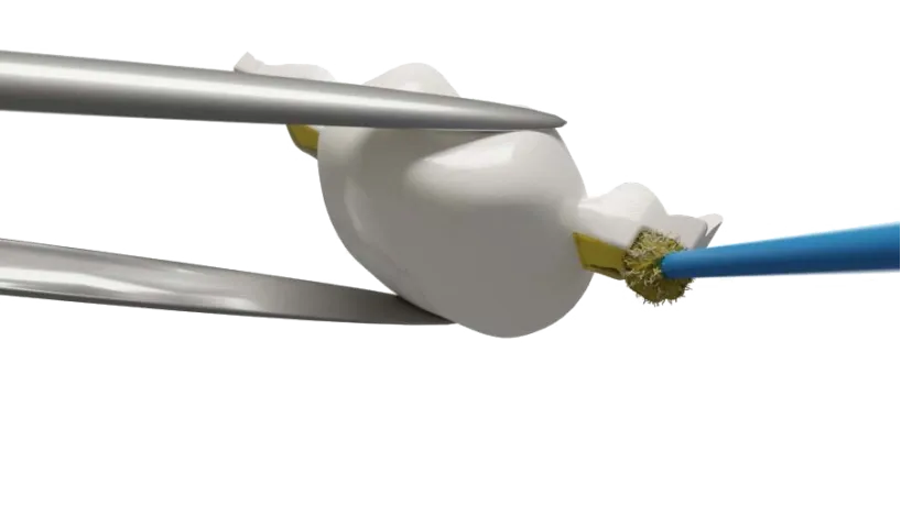 Dentapreg® BUNDLE prepared for application on tooth model using tools.