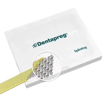 Dentapreg restorations for bridges, splints and retainers