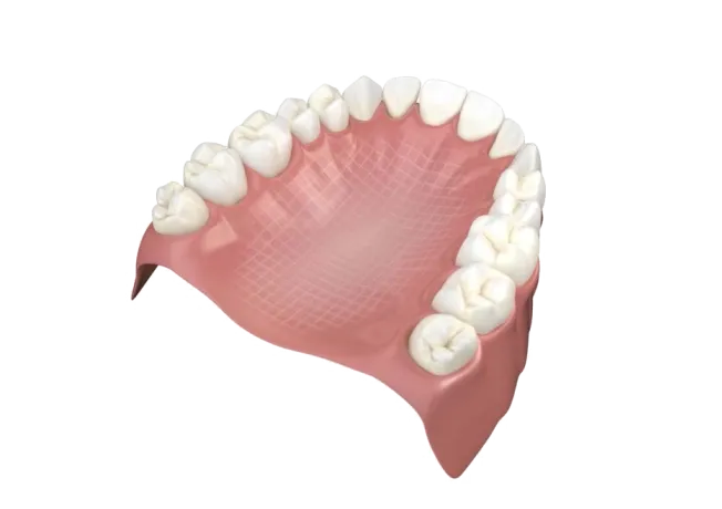 Dentapreg® MESH fiber reinforcement for durable dental prosthetics and restorations.
