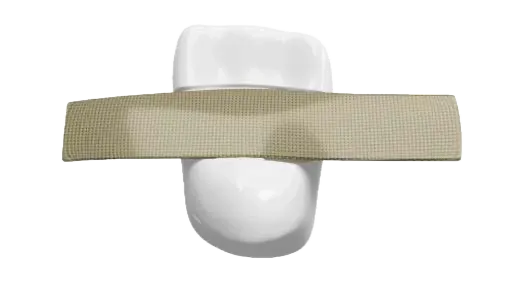Dentapreg PFM fiber strip on model tooth for dental stabilization splints.